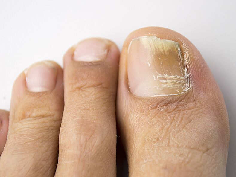 The initial stage of fungi