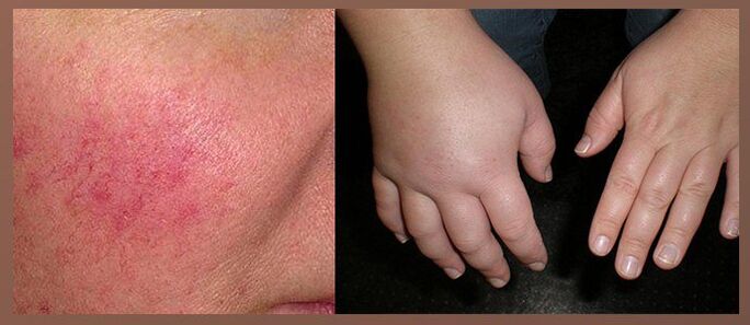 Side effects of drip